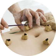 Moxibustion